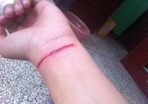 割手腕图片,揭开生命边缘的脆弱与勇气